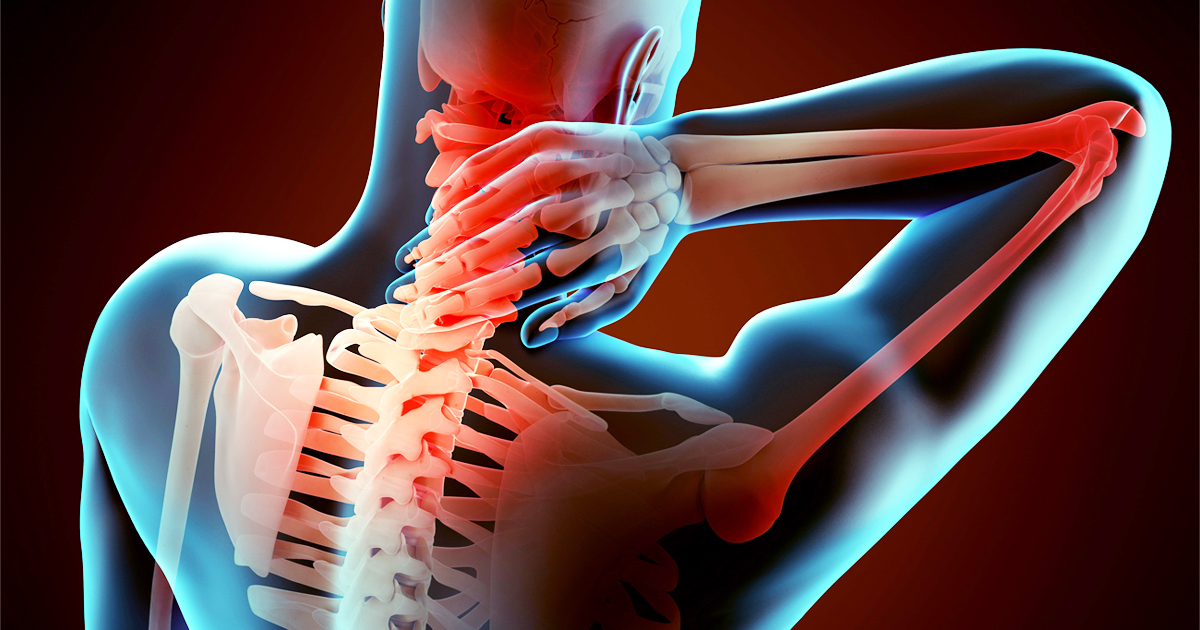 Nekpijn; wat zijn de oorzaken en wat kan je er aan doen?